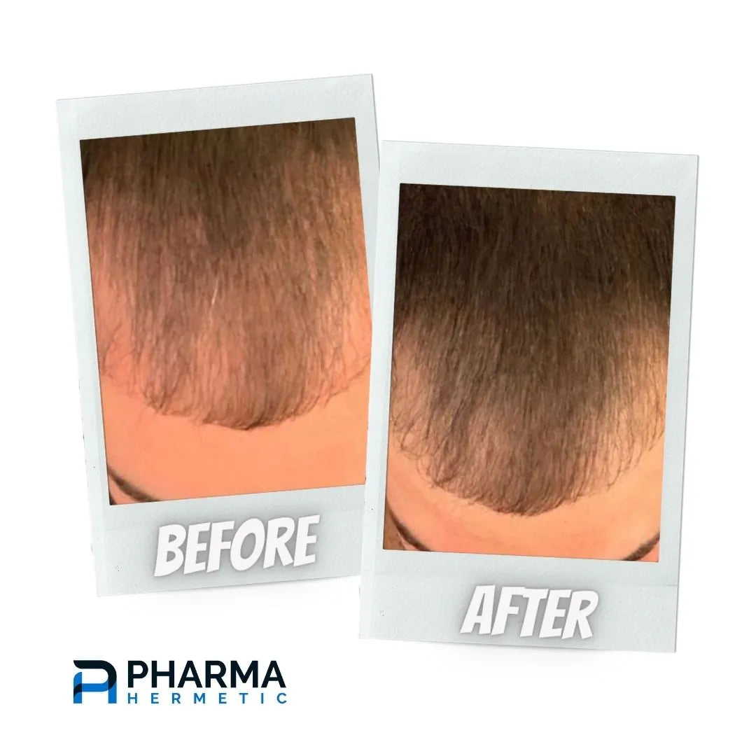Hair treatment before and after, photo 4 of 12