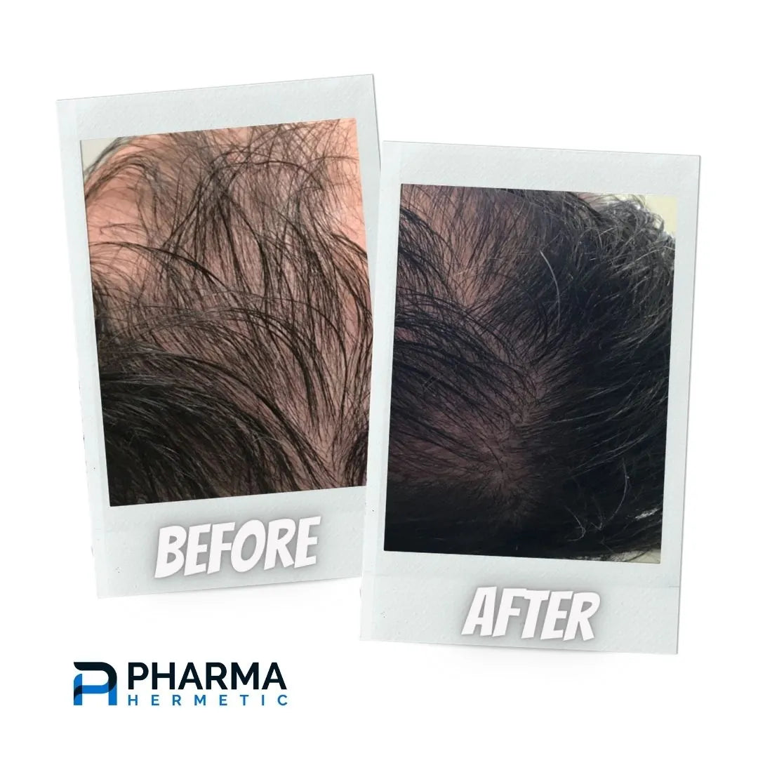 Hair treatment before and after, photo 4 of 7