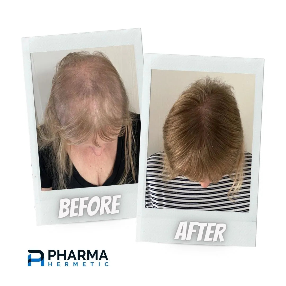 Hair treatment before and after, photo 5 of 6
