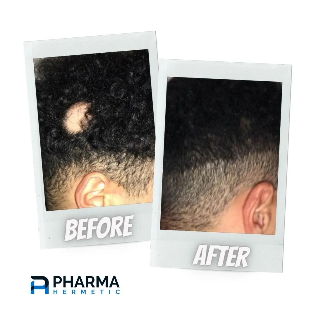 Hair treatment before and after, photo 4 of 6