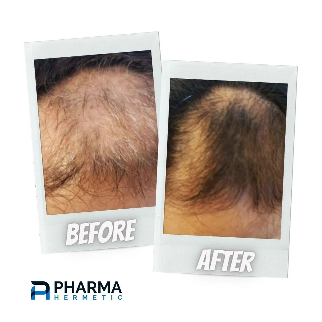 Hair treatment before and after, photo 3 of 6