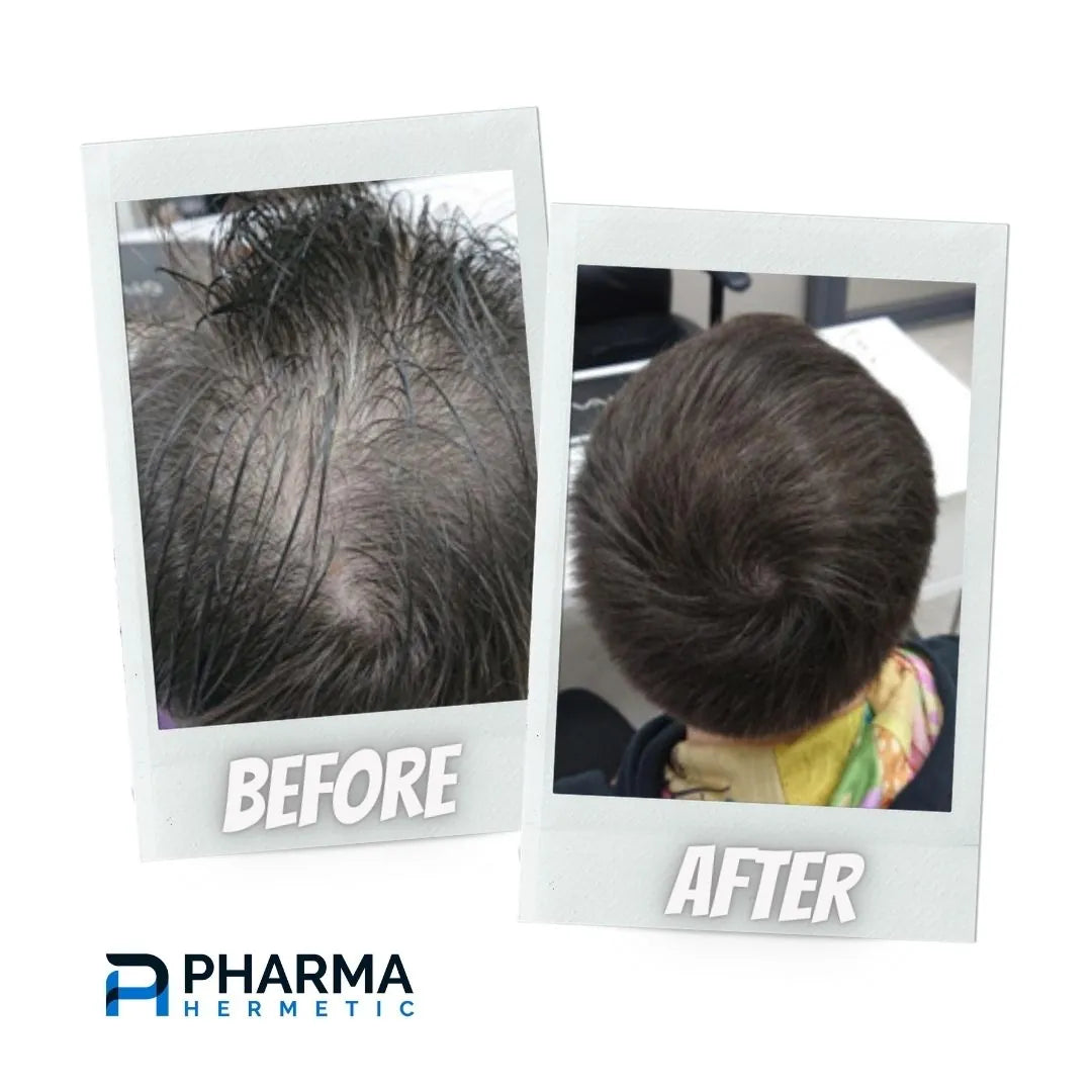Hair treatment before and after, photo 5 of 7