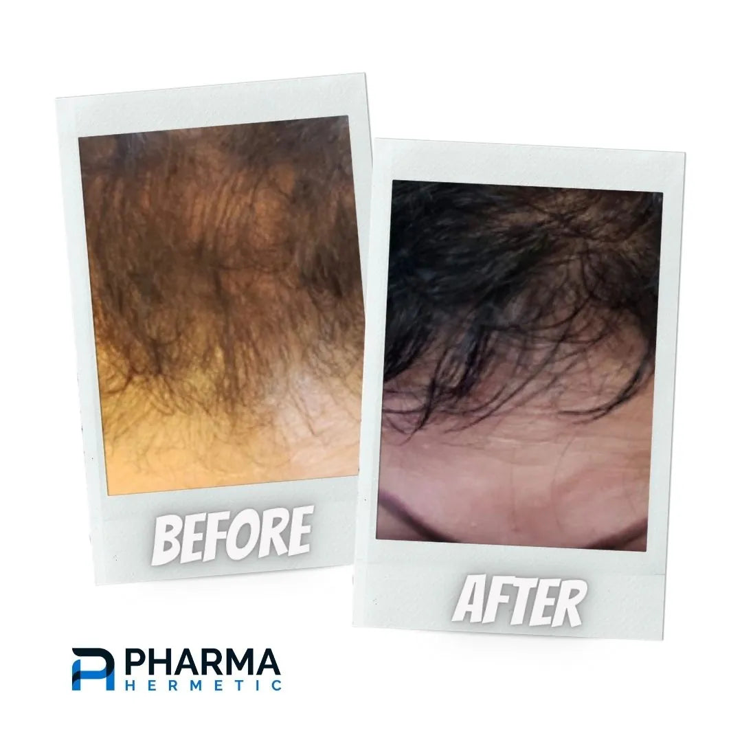 Hair treatment before and after, photo 2 of 6