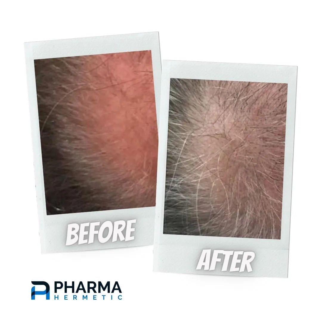 Hair treatment before and after, photo 8 of 12