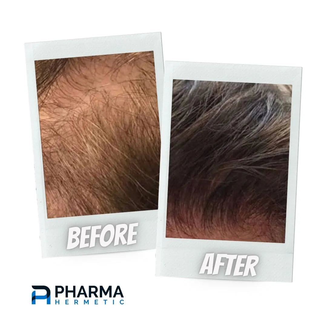 Hair treatment before and after, photo 7 of 12