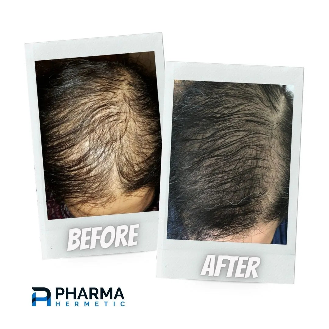 Hair treatment before and after, photo 6 of 6
