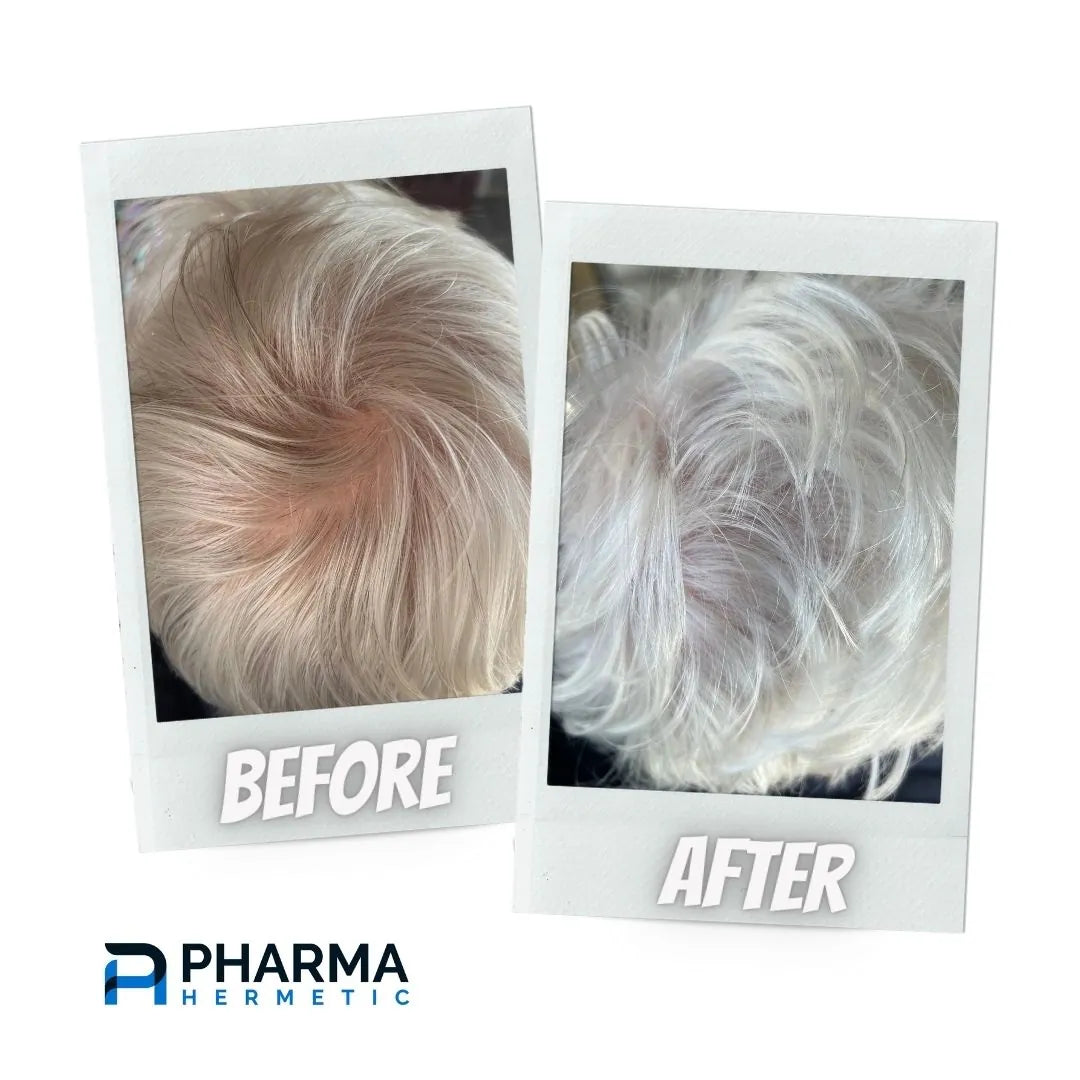 Hair treatment before and after, photo 1 of 6